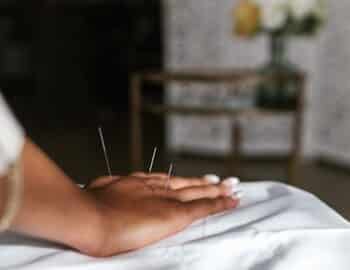 A-Person-Having-an-Acupuncture-Treatment