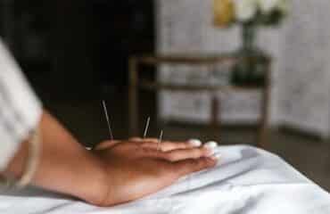 A-Person-Having-an-Acupuncture-Treatment